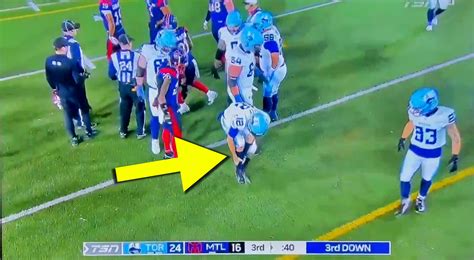 Chad Kelly Leg Injury