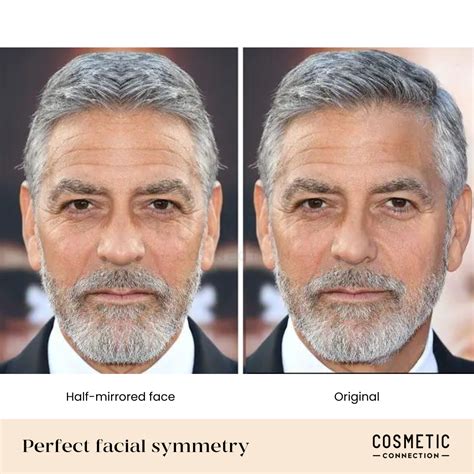 Facial symmetry विभाजन