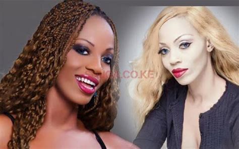 Skin Bleaching in Africa
